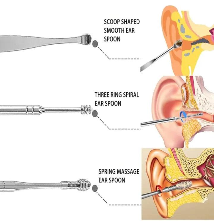 Premium Stainless Steel Ear Wax Removal Kit – Safe, Effective & Travel-Friendly