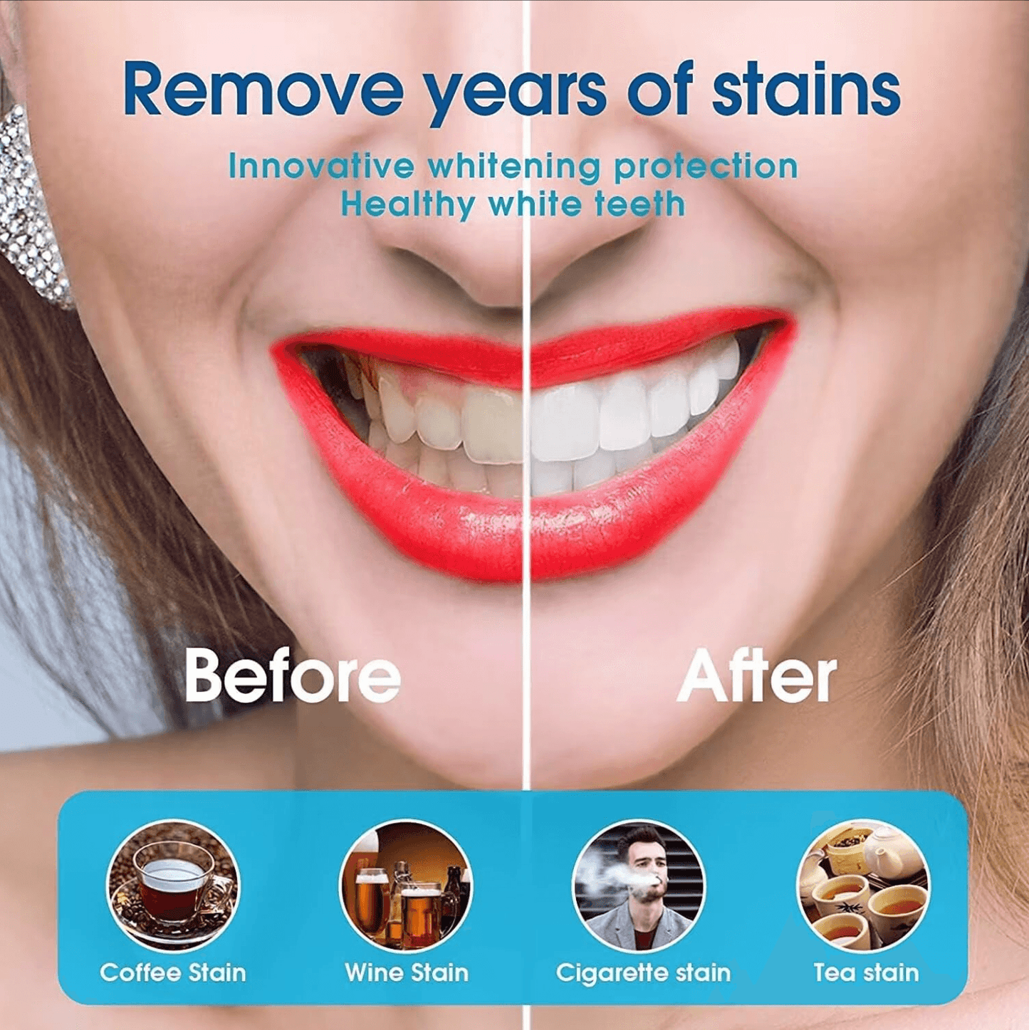 Instant Teeth Whitening at Home – No Sensitivity, Just Results!